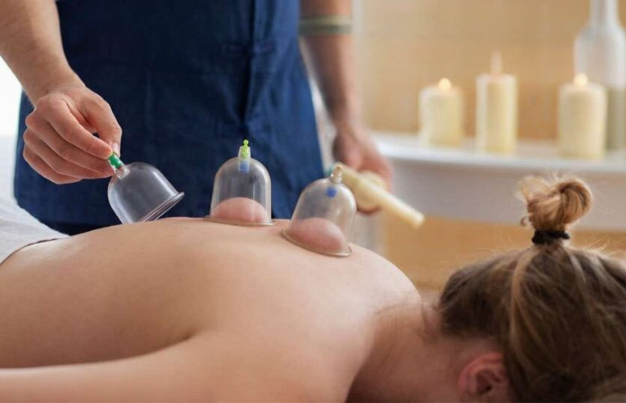 Cupping therapy