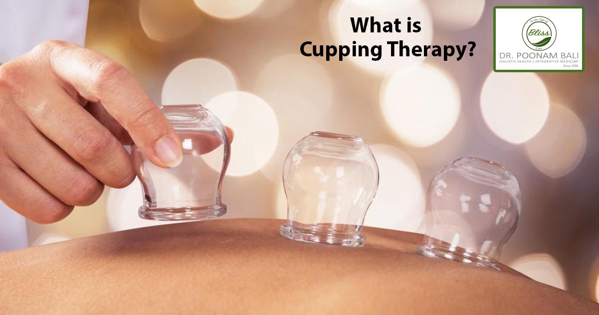 What is Cupping therapy?