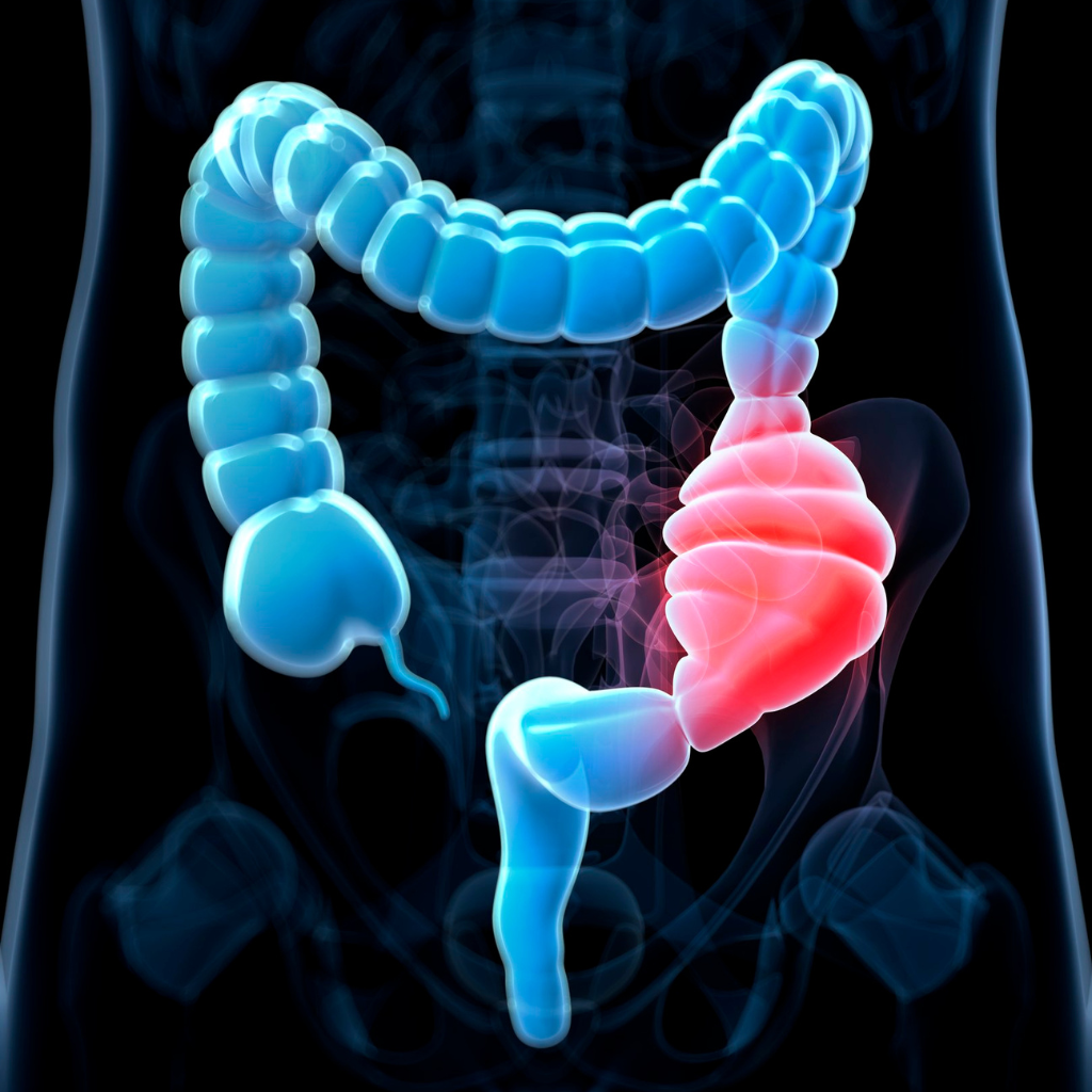 Food Nutrition and Balanced Diet