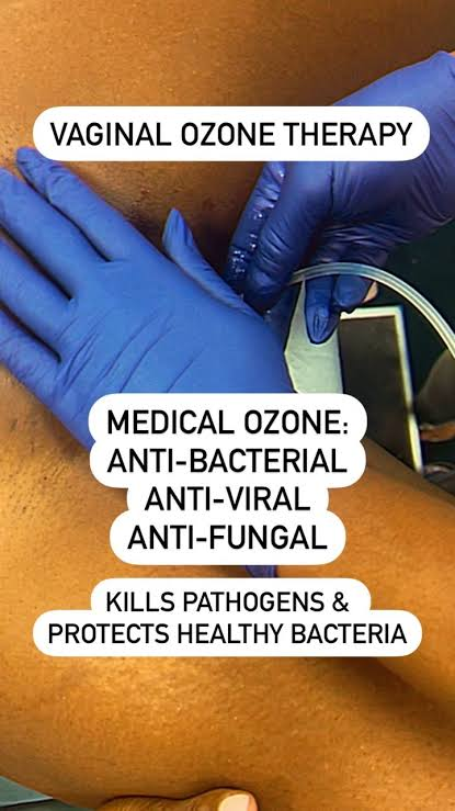 Vaginal Ozone Therapy